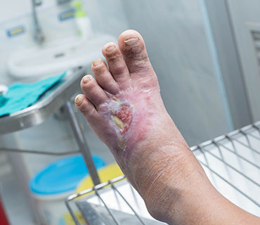 Wound Care Clinic